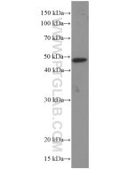 PHD2/EGLN1 Monoclonal antibody proteintech 66589-1-Ig