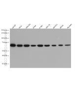 AIF Monoclonal antibody proteintech 67791-1-Ig