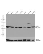 ACOX1 Monoclonal antibody proteintech 68017-1-Ig