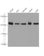 PMS2 Monoclonal antibody proteintech 68905-5-Ig