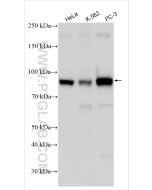 CD71 Monoclonal antibody proteintech 65236-1-Ig