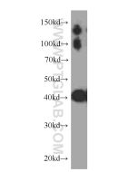 CKM-Specific Monoclonal antibody proteintech 60177-1-Ig