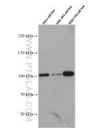 CUL4B Monoclonal antibody proteintech 60151-1-Ig