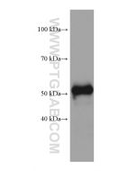 OXCT1 Monoclonal antibody proteintech 67836-1-Ig