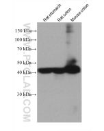 Alpha smooth muscle actin specific Monoclonal antibody proteintech 67735-1-Ig