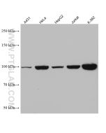 Alix Monoclonal antibody proteintech 67715-1-Ig