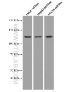 Pyruvate Carboxylase Monoclonal antibody proteintech 66615-1-Ig