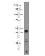 TTF1/NKX2-1 Monoclonal antibody proteintech 66034-1-Ig