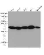 RPLP0 Monoclonal antibody proteintech 68056-1-Ig