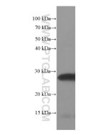 SNAP25 Monoclonal antibody proteintech 60159-1-Ig
