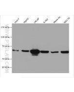 PCK2 Monoclonal antibody proteintech 67676-1-Ig