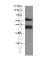 SPARC Monoclonal antibody proteintech 66426-1-Ig