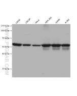 LBR Monoclonal antibody proteintech 68378-1-Ig