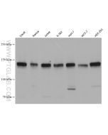 PERK/EIF2AK3 Monoclonal antibody proteintech 68482-1-Ig