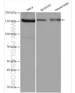PPARGC1B Monoclonal antibody proteintech 67821-1-Ig