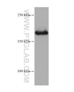 CD206 Monoclonal antibody proteintech 60143-1-Ig
