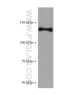 Collagen Type I Monoclonal antibody proteintech 67288-1-Ig