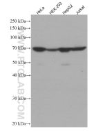 Transketolase Monoclonal antibody proteintech 66016-1-Ig