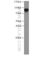 TLE3 Monoclonal antibody proteintech 66083-1-Ig