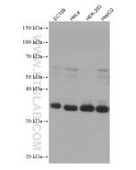 ART1 Monoclonal antibody proteintech 66958-1-Ig
