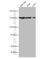 GLI1 Monoclonal antibody proteintech 66905-1-Ig