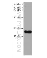 Ferritin light chain Monoclonal antibody proteintech 68068-1-Ig
