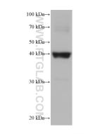Cardiac Troponin T Monoclonal antibody proteintech 68300-1-Ig