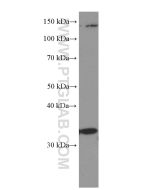 Cyclin D3 Monoclonal antibody proteintech 66357-1-Ig