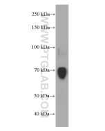 Factor VIII Monoclonal antibody proteintech 66722-1-Ig