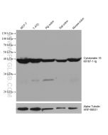 Cytokeratin 19 Monoclonal antibody proteintech 60187-1-Ig