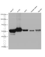 Cytokeratin 5 Monoclonal antibody proteintech 66727-1-Ig