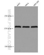 EIF3A Monoclonal antibody proteintech 67713-1-Ig