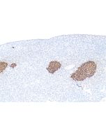 Ins1 Monoclonal antibody proteintech 67668-1-Ig