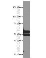 Myocilin Monoclonal antibody proteintech 60357-1-Ig