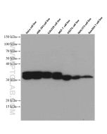 PYCR1 Monoclonal antibody proteintech 66510-1-Ig