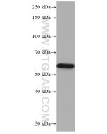 CES1 Monoclonal antibody proteintech 67079-1-Ig