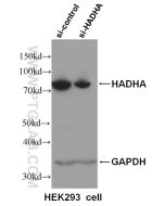 HADHA Monoclonal antibody proteintech 60250-1-Ig