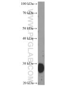 Adiponectin Monoclonal antibody proteintech 66239-1-Ig