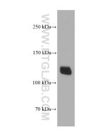 Desmocollin 2 Monoclonal antibody proteintech 60239-1-Ig