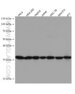 SBDS Monoclonal antibody proteintech 67200-1-Ig