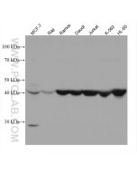 CD24 Monoclonal antibody proteintech 67627-1-Ig