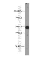 PAX8 Monoclonal antibody proteintech 60145-4-Ig