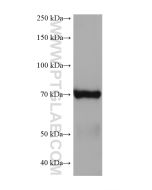 5 Lipoxygenase Monoclonal antibody proteintech 66326-1-Ig