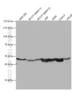 ESRRB Monoclonal antibody proteintech 66818-1-Ig