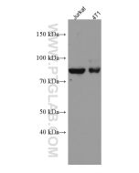 PRLR Monoclonal antibody proteintech 67292-1-Ig