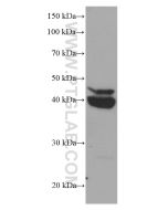 CEBPB Monoclonal antibody proteintech 66649-1-Ig