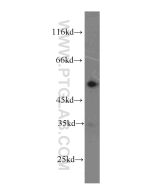 LYN Monoclonal antibody proteintech 60211-1-Ig