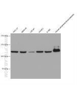 Vinculin Monoclonal antibody proteintech 66305-2-Ig