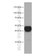 Tissue Factor/CD142 Monoclonal antibody proteintech 67056-1-Ig