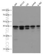 KLF6 Monoclonal antibody proteintech 67297-1-Ig